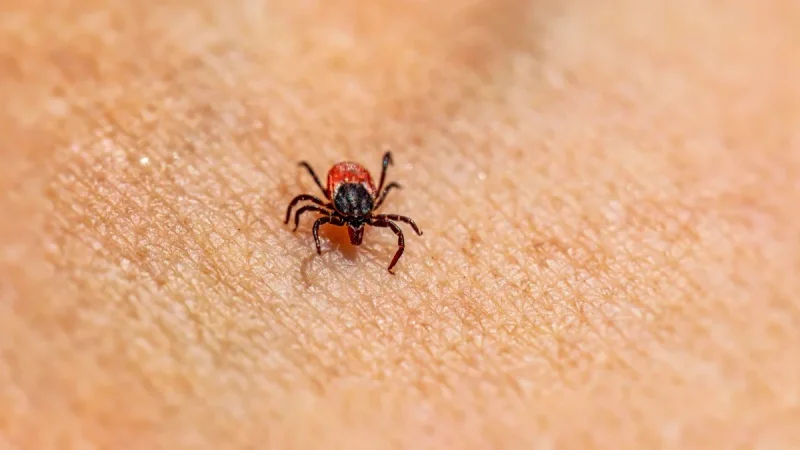 How to Safely Remove a Tick From Your Skin, Step by Step
